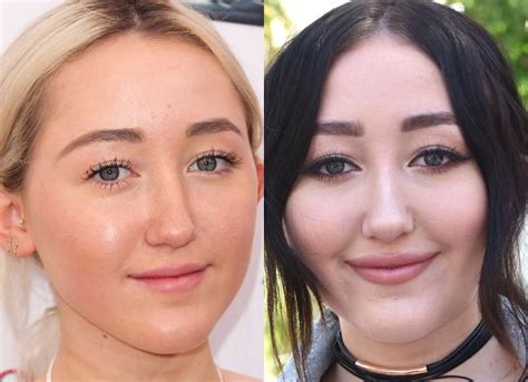 noah cyrus plastic surgery|The Stunning Transformation Of Noah Cyrus